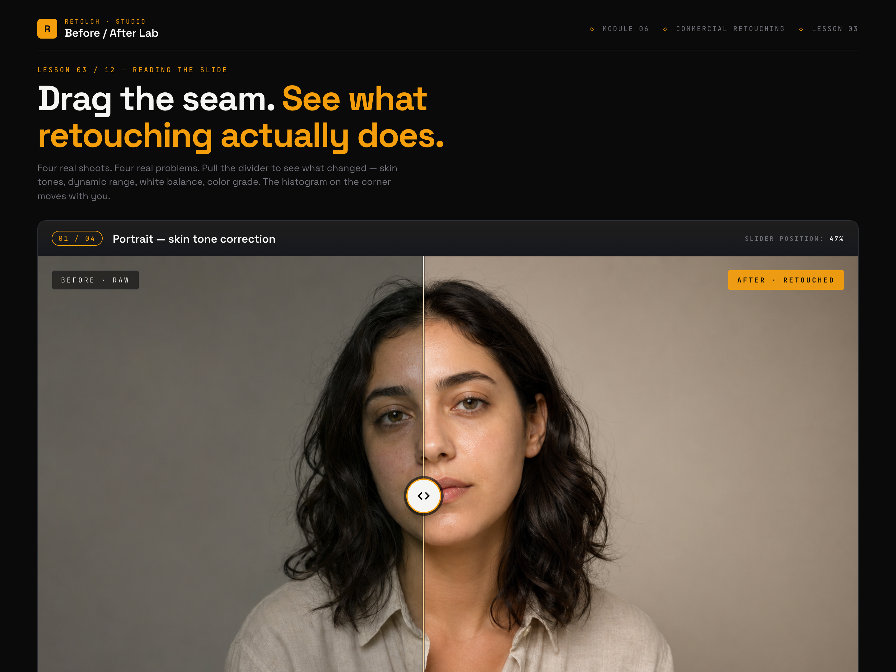 Before / After Slider — Foundational Variant preview