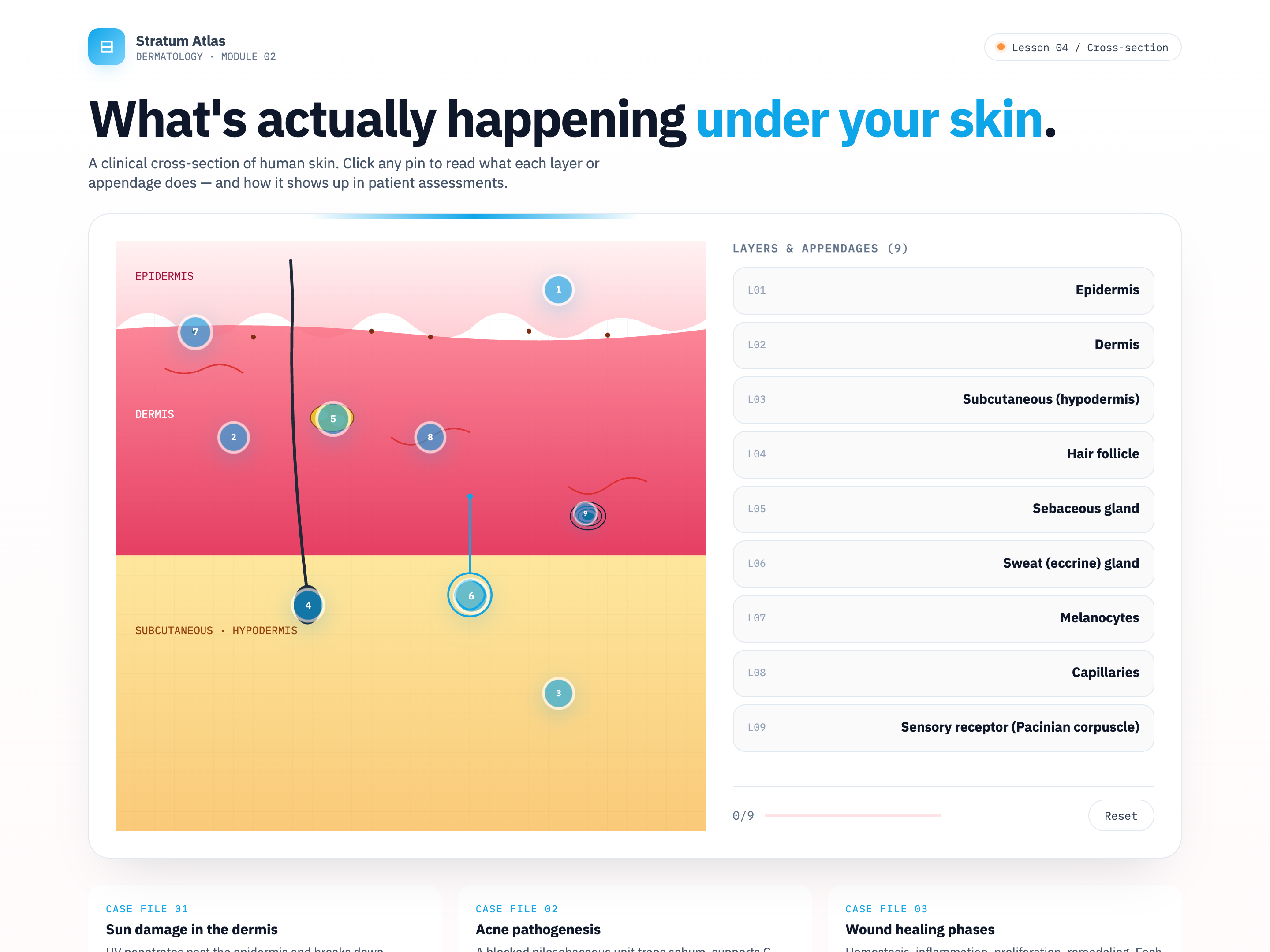 Hotspot Reveal Diagram — Layered Cross-Section Variant preview
